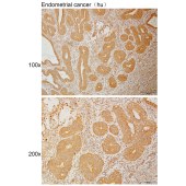 Solarbio K110945P Anti-FCHO2 Polyclonal Antibody
