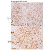 Solarbio K110601P Anti-GBP1 Polyclonal Antibody