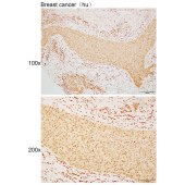 Solarbio K110542P Anti-ALX1 Polyclonal Antibody