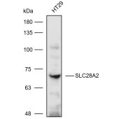Solarbio K111066P Anti-SLC28A2 Polyclonal Antibody