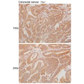 Solarbio K111298P Anti-ARHGAP17 Polyclonal Antibody