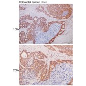 Solarbio K111714P Anti-CCDC28B Polyclonal Antibody