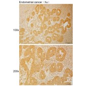 Solarbio K111003P Anti-FIGNL1 Polyclonal Antibody
