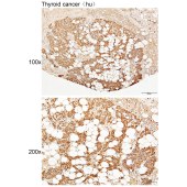 Solarbio K111417P Anti-VPS25 Polyclonal Antibody