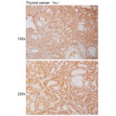 Solarbio K111031P Anti-PPP1R3B Polyclonal Antibody