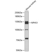 Solarbio K009991P Anti-NPHS1 Polyclonal Antibody