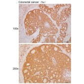 Solarbio K111703P Anti-CCDC70 Polyclonal Antibody