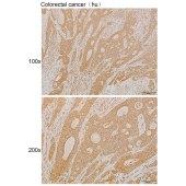 Solarbio K111894P Anti-PROM1 Polyclonal Antibody