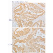 Solarbio K110570P Anti-EIF2A Polyclonal Antibody