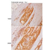 Solarbio K111985P Anti-BIRC7 Polyclonal Antibody
