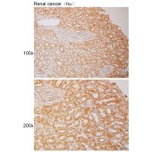 Solarbio K111096P Anti-ITGB3 Polyclonal Antibody