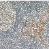 Solarbio K009918P Anti-PD-L1/CD274 Polyclonal Antibody