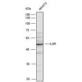 Solarbio K111696P Anti-IL9R Polyclonal Antibody
