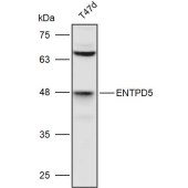 Solarbio K110994P Anti-ENTPD5 Polyclonal Antibody