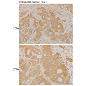 Solarbio K111921P Anti-MMP13 Polyclonal Antibody