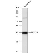 Solarbio K111758P Anti-FBXO25 Polyclonal Antibody