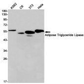 Solarbio K009921P Anti-ATGL Polyclonal Antibody