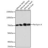 Solarbio K009922M Anti-Perilipin A Monoclonal Antibody