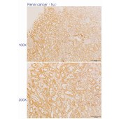 Solarbio K110575P Anti-NFE2L2 Polyclonal Antibody