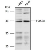 Solarbio K111271P Anti-FOXB2 Polyclonal Antibody