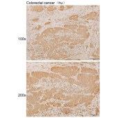 Solarbio K111868P Anti-ETV6 Polyclonal Antibody