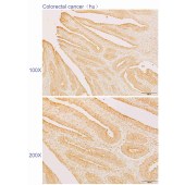 Solarbio K110557P Anti-ATP2A2 Polyclonal Antibody