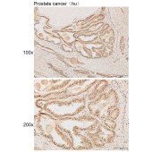 Solarbio K111899P Anti-SNAI1 Polyclonal Antibody