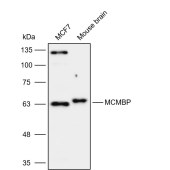 Solarbio K112134P Anti-MCMBP Polyclonal Antibody