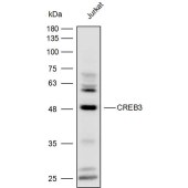 Solarbio K111904P Anti-CREB3 Polyclonal Antibody