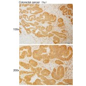 Solarbio K110935P Anti-TBC1D20 Polyclonal Antibody