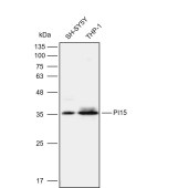 Solarbio K112100P Anti-PI15 Polyclonal Antibody