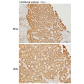 Solarbio K111639P Anti-MYBPC3 Polyclonal Antibody