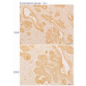 Solarbio K110595P Anti-PPFIA1 Polyclonal Antibody