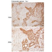 Solarbio K111946P Anti-SOCS6 Polyclonal Antibody