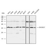 Solarbio K111954P Anti-EXOSC7 Polyclonal Antibody