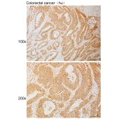 Solarbio K111083P Anti-CHPF Polyclonal Antibody