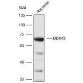 Solarbio K111019P Anti-DDX43 Polyclonal Antibody