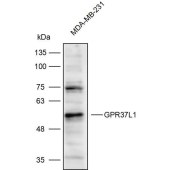 Solarbio K111867P Anti-GPR37L1 Polyclonal Antibody