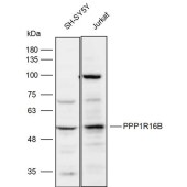 Solarbio K111875P Anti-PPP1R16B Polyclonal Antibody