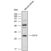 Solarbio K111767P Anti-CA13 Polyclonal Antibody
