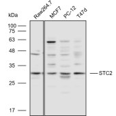 Solarbio K110563P Anti-STC2 Polyclonal Antibody