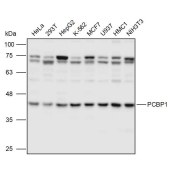 Solarbio K111024P Anti-PCBP1 Polyclonal Antibody