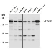 Solarbio K111227P Anti-DPYSL2 Polyclonal Antibody