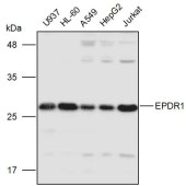 Solarbio K111005P Anti-EPDR1 Polyclonal Antibody