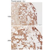 Solarbio K111418P Anti-HCFC1 Polyclonal Antibody