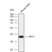 Solarbio K111988P Anti-ART3 Polyclonal Antibody