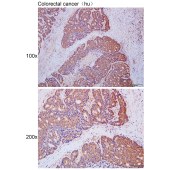 Solarbio K111658P Anti-RGS18 Polyclonal Antibody