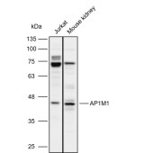 Solarbio K112101P Anti-AP1M1 Polyclonal Antibody