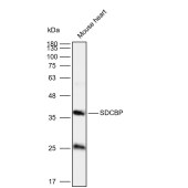 Solarbio K112127P Anti-SDCBP Polyclonal Antibody