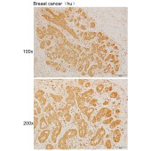 Solarbio K111464P Anti-METTL6 Polyclonal Antibody